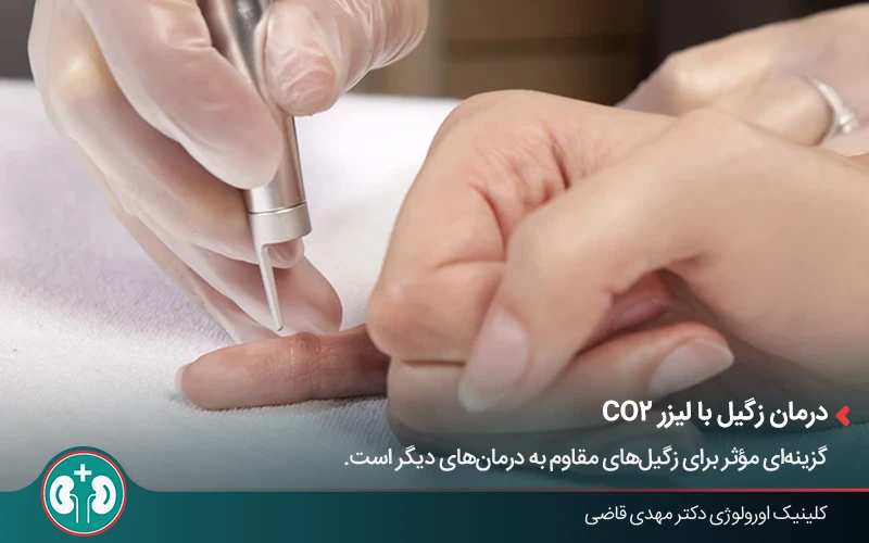 استفاده از لیزر برای درمان ضایعات پوستی