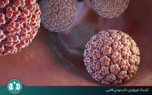 مقایسه روش‌های درمان زگیل تناسلی؛ بهترین روش درمان کدام است؟