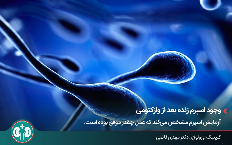 تصویر ماکروسکوپی از اسپرم در حال حرکت؛ بررسی درصد خطای وازکتومی و صفر نشدن اسپرم