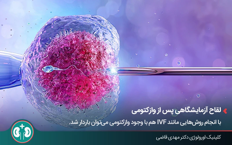 لحظه لقاح اسپرم و تخمک؛ احتمال حاملگی با وجود وازکتومی در شرایط خاص