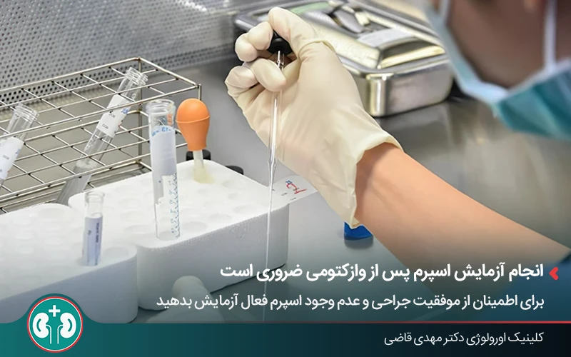 انجام آزمایش منی پس از انجام وازکتومی