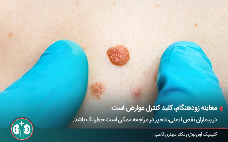 معاینه ضایعات مشکوک پوستی ناشی از HPV