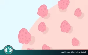 علائم زگیل تناسلی چیست؟ راهنمای کامل تشخیص و بررسی تفاوت‌ها