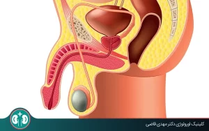 تاثیر وازکتومی بر پروستات؛ هر آنچه باید بدانید
