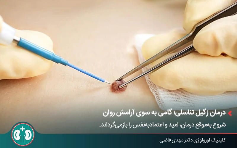 درمان زگیل تناسلی با استفاده از روشهای فیزیکی و لیزر