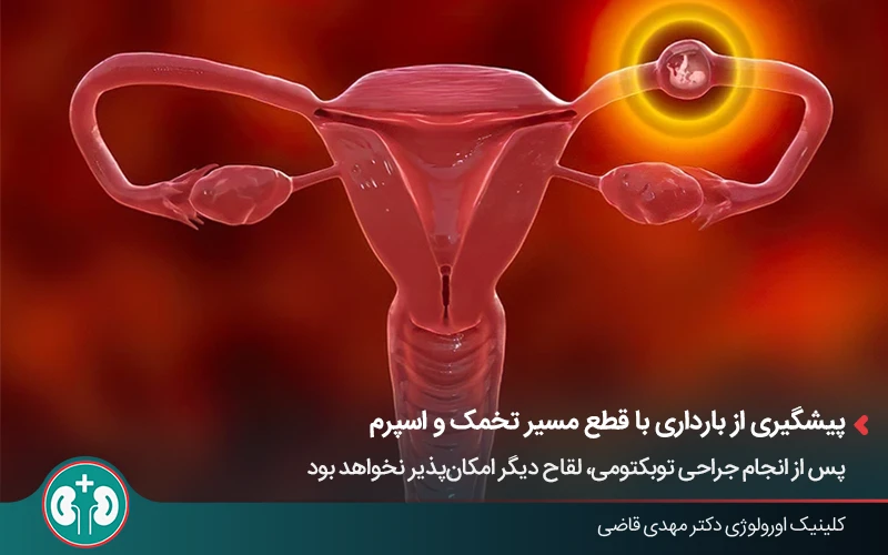 نحوه عملکرد لولههای فالوپ در انتقال تخمک و تأثیر توبکتومی بر ناباروری