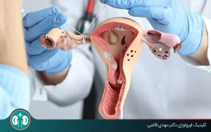 جراحی توبکتومی زنان چیست؟ + مزایا و معایب و عوارض احتمالی
