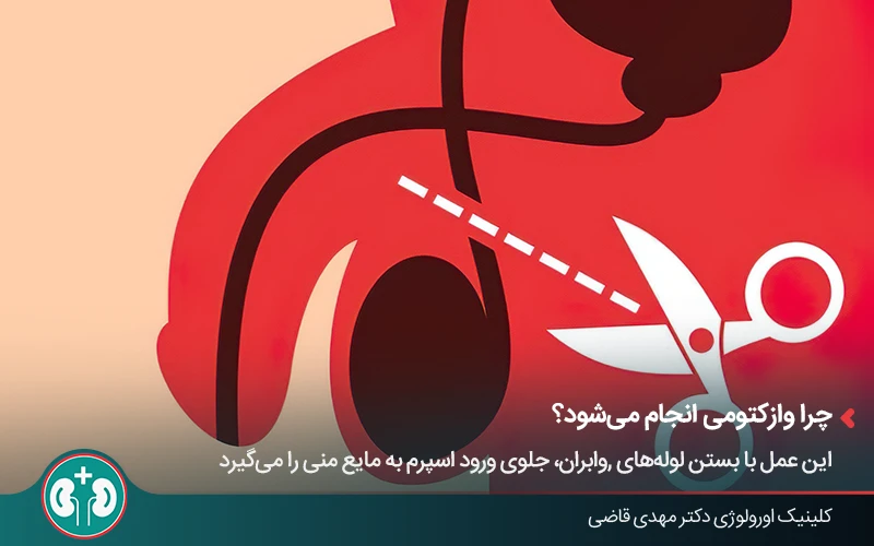 vasectomy complications 1
