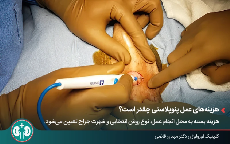 What is Penoplasty 4