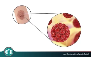 آیا بعد از درمان زگیل تناسلی می‌توان رابطه جنسی داشت؟