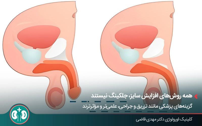 روش‌های علمی برای افزایش سایز آلت تناسلی