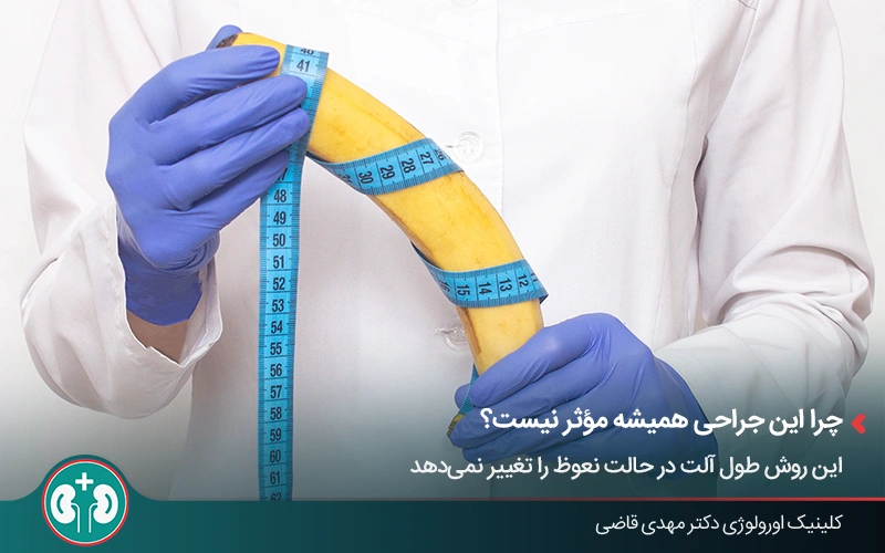 اندازه‌گیری طول آلت قبل از جراحی افزایش طول آلت تناسلی