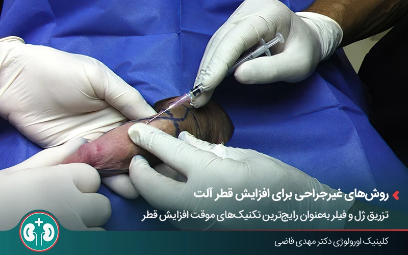 افزایش قطر آلت با تزریق فیلر یا چربی