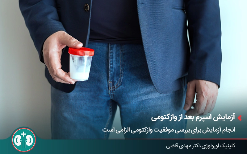 آزمایش اسپرم پس از وازکتومی و ارائه نمونه توسط بیمار