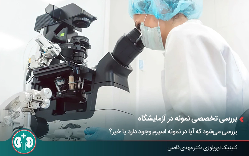 آنالیز اسپرم پس از عمل وازکتومی زیر میکروسکوپ