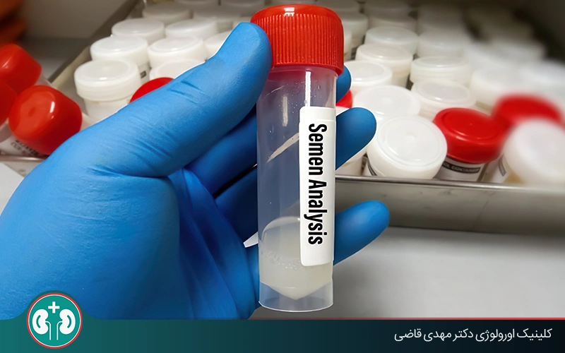 semen analysis after vasectomy
