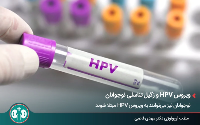 آزمایش HPV برای تشخیص زگیل تناسلی در نوجوانان