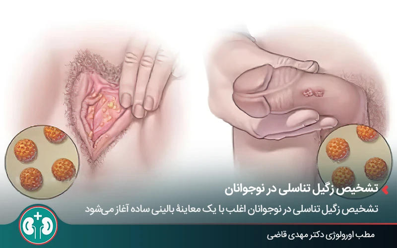 علائم زگیل تناسلی در نوجوانان و نشانه‌های ابتلا به HPV