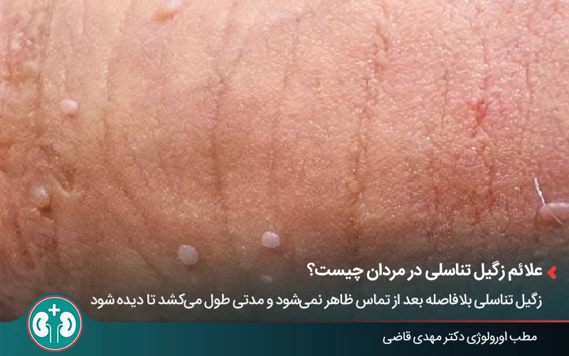 complications genital warts men 1