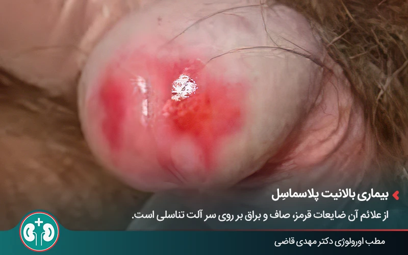 genital skin lesions 14