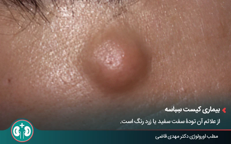 genital skin lesions 16