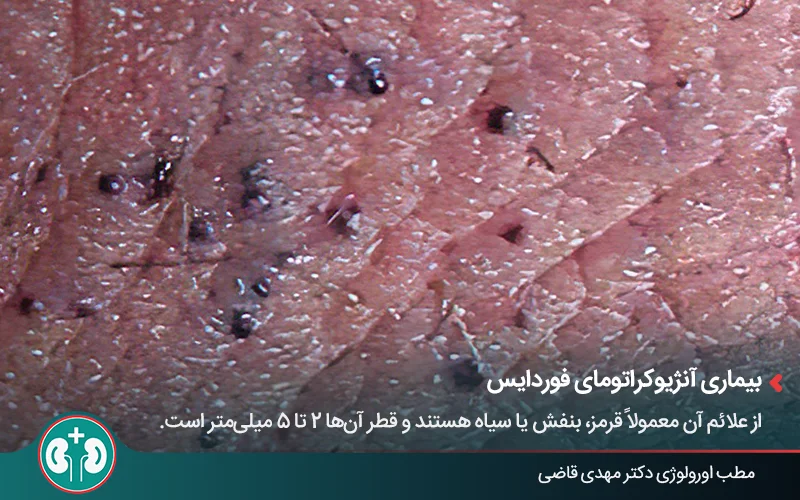 genital skin lesions 18