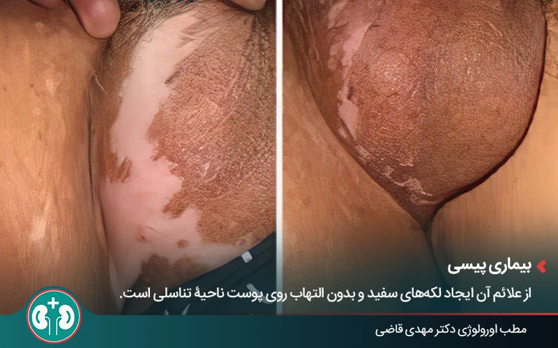genital skin lesions 2