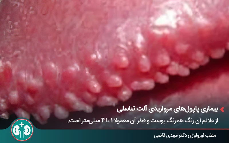 genital skin lesions 21