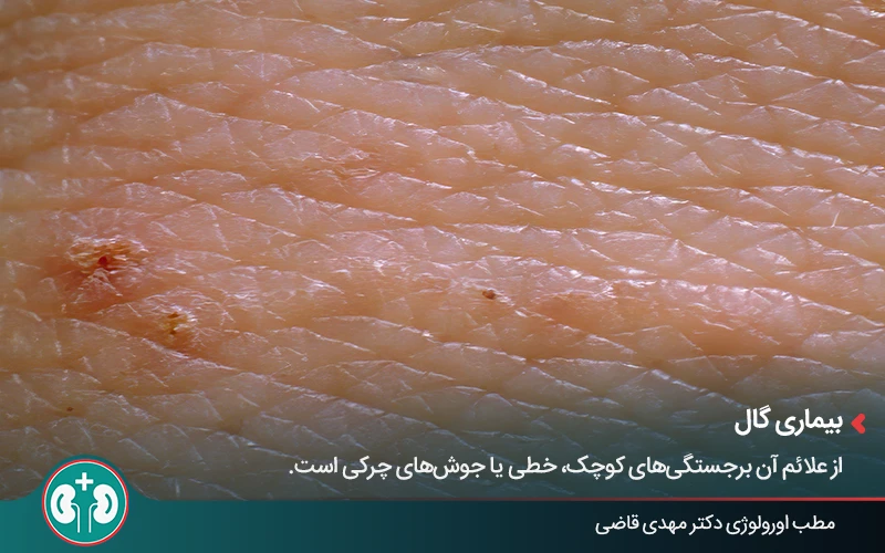 genital skin lesions 24