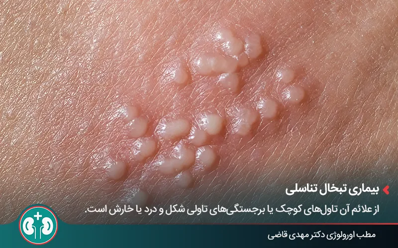 genital skin lesions 28