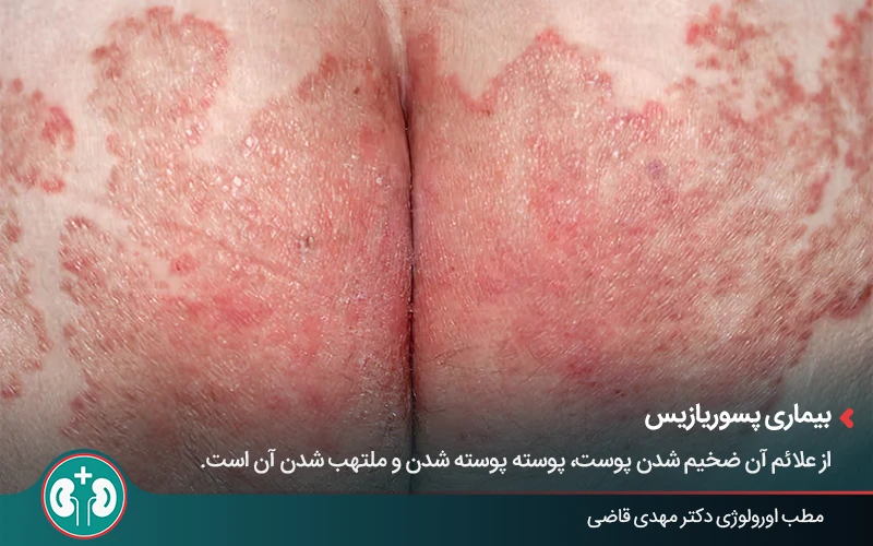 genital skin lesions 3