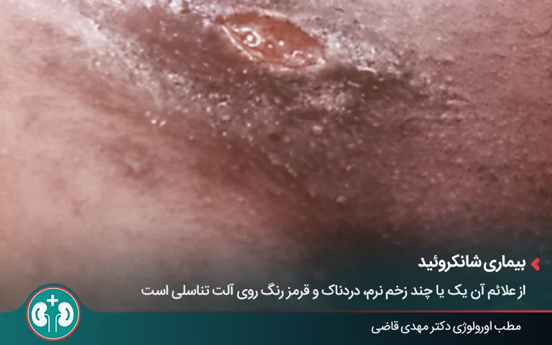 genital skin lesions 32 1
