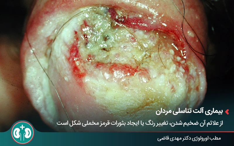 genital skin lesions 33 1