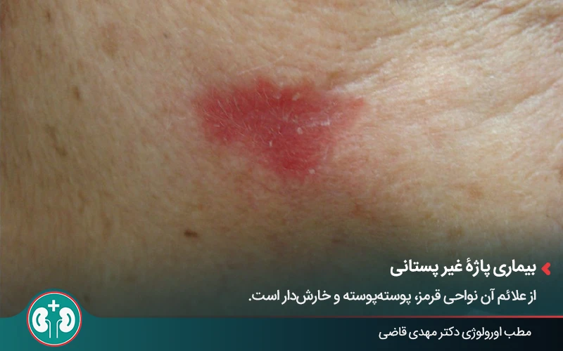 genital skin lesions 34