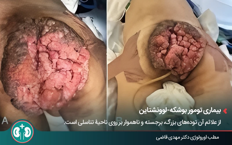 genital skin lesions 35