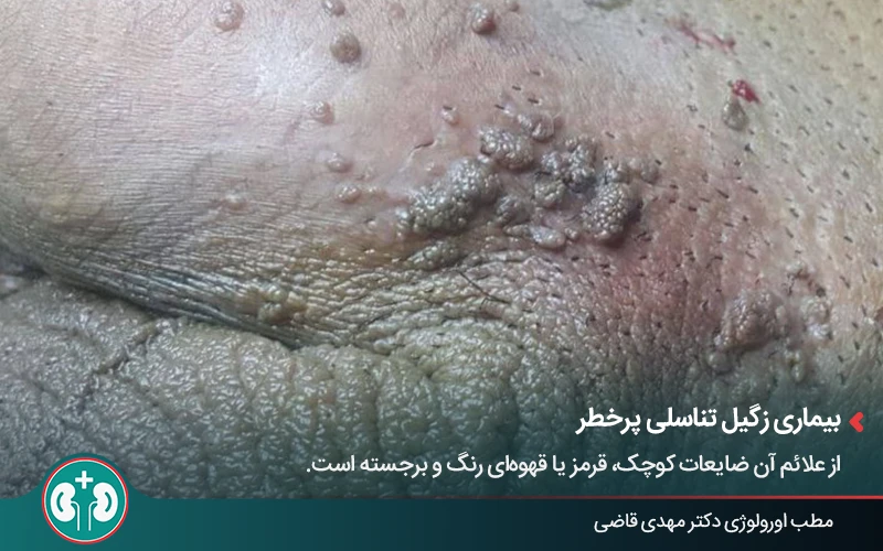 genital skin lesions 36