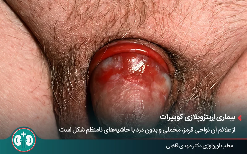genital skin lesions 37 1
