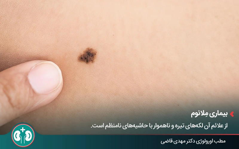 genital skin lesions 38
