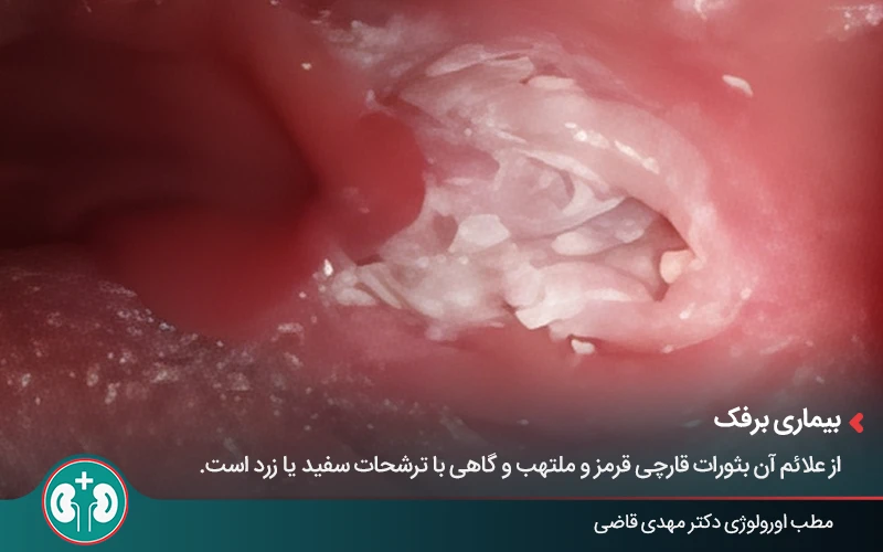 genital skin lesions 6