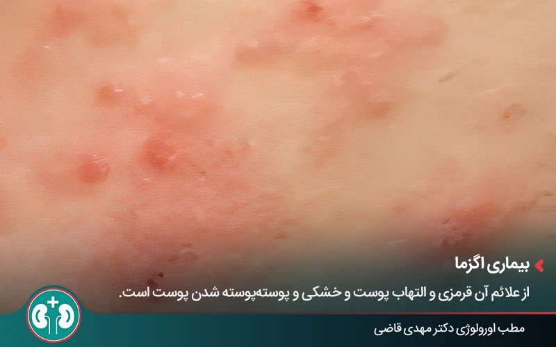 genital skin lesions 8