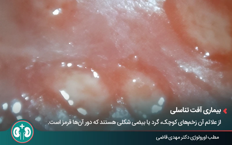 genital skin lesions 9