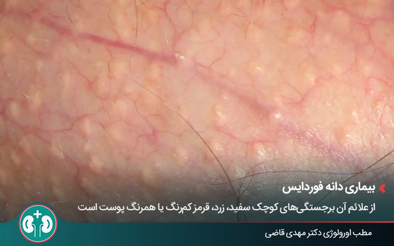 genital skin lesionss 17