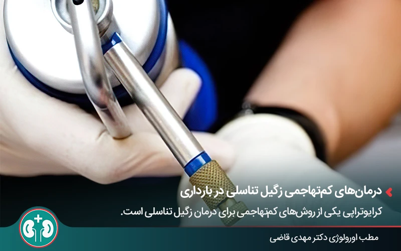 کرایوتراپی؛ یکی از روش‌های درمان زگیل تناسلی