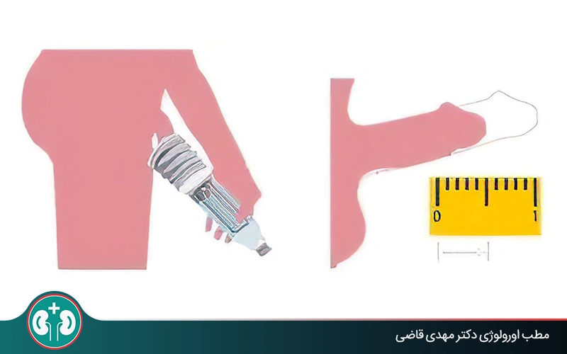 روش‌های طبیعی و خانگی بزرگ کردن آلت تناسلی؛ بررسی علمی + هشدارهای پزشکی