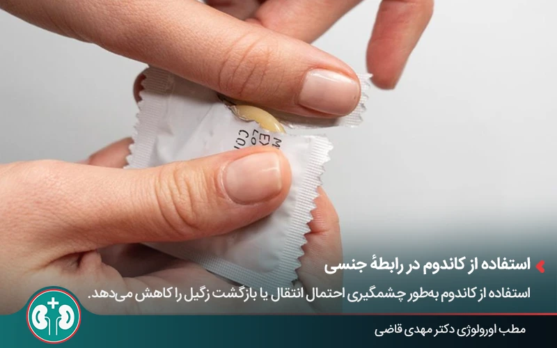 استفاده از کاندوم در رابطه جنسی برای جلوگیری از عود مجدد زگیل تناسلی