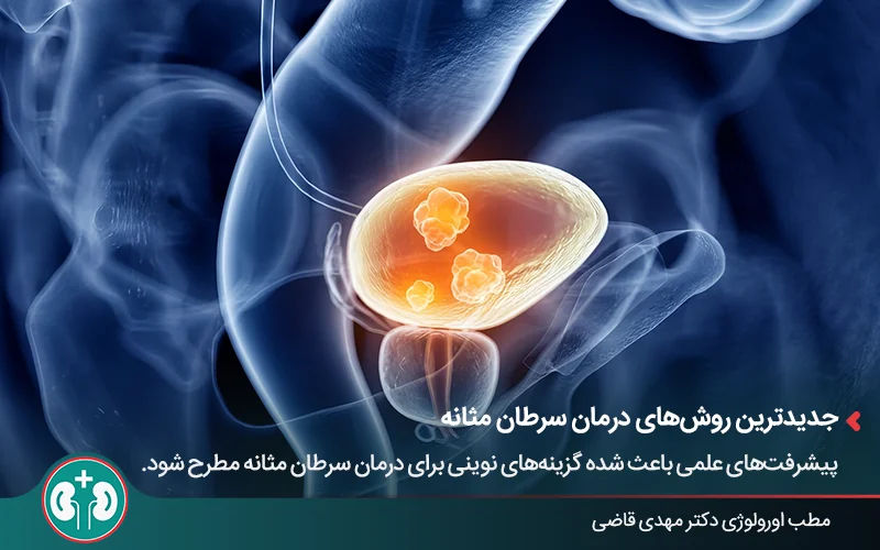 نمای سه بعدی سلول های سرطانی مثانه و روش های جدید درمان سرطان مثانه