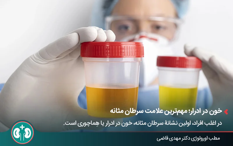 تصویر مردی که ۲ نمونۀ ادرار با رنگهای مختلف در دست دارد