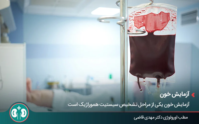 تصویر کیسه خون برای تزریق و انتقال خون در بیمارستان