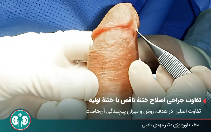 adult circumcision revision 01