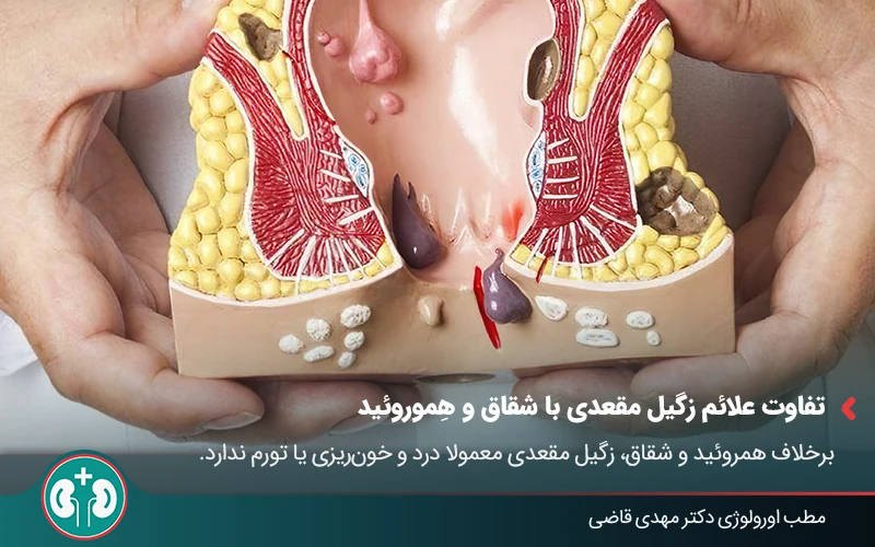 anal warts symptoms 01